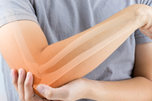 Cape Cod Orthopedics arm.png