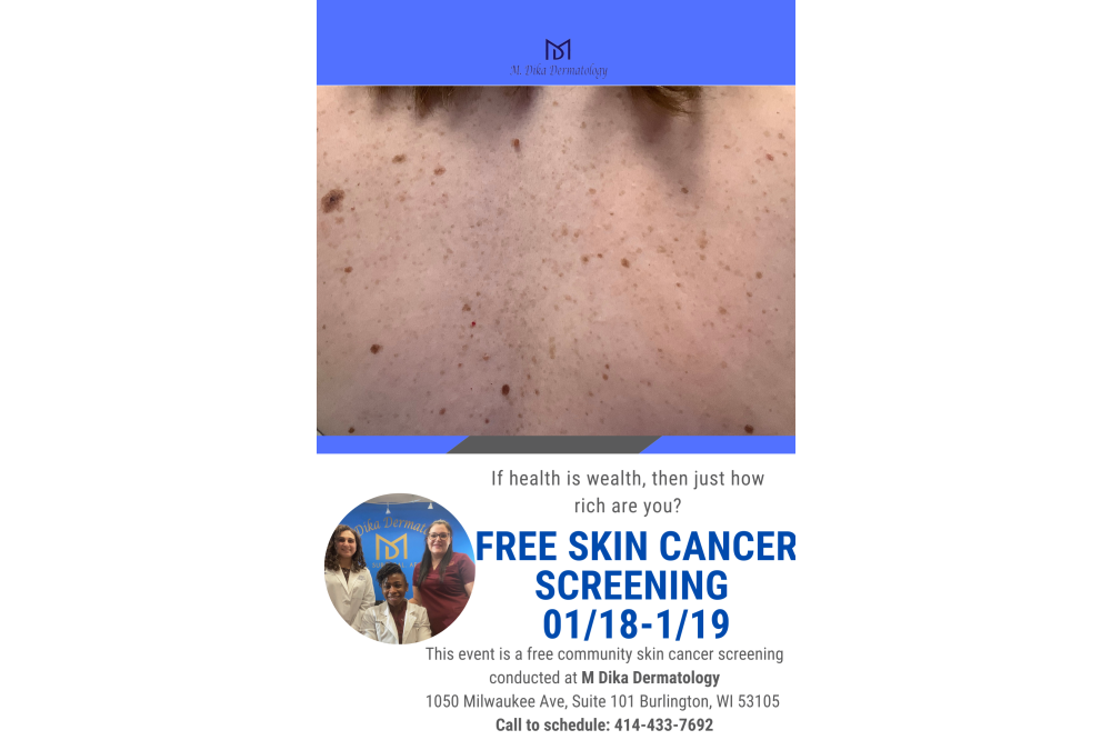 Free Skin Cancer screening