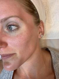 spa treatment