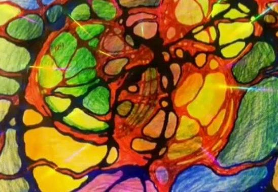 Neurographics: Removal of Restrictions Art