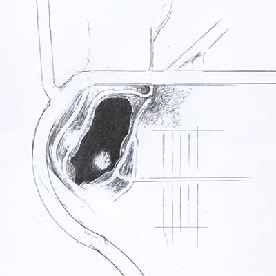 Map of Gage Park Pond | Mulvane Art Museum