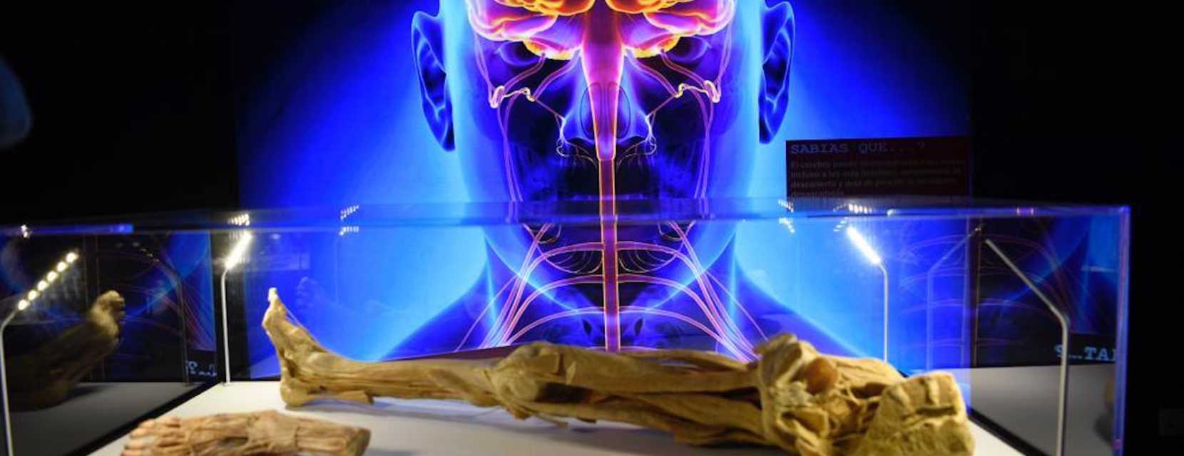 Bodies: The Science Within exhibition in Denver, Colorado.