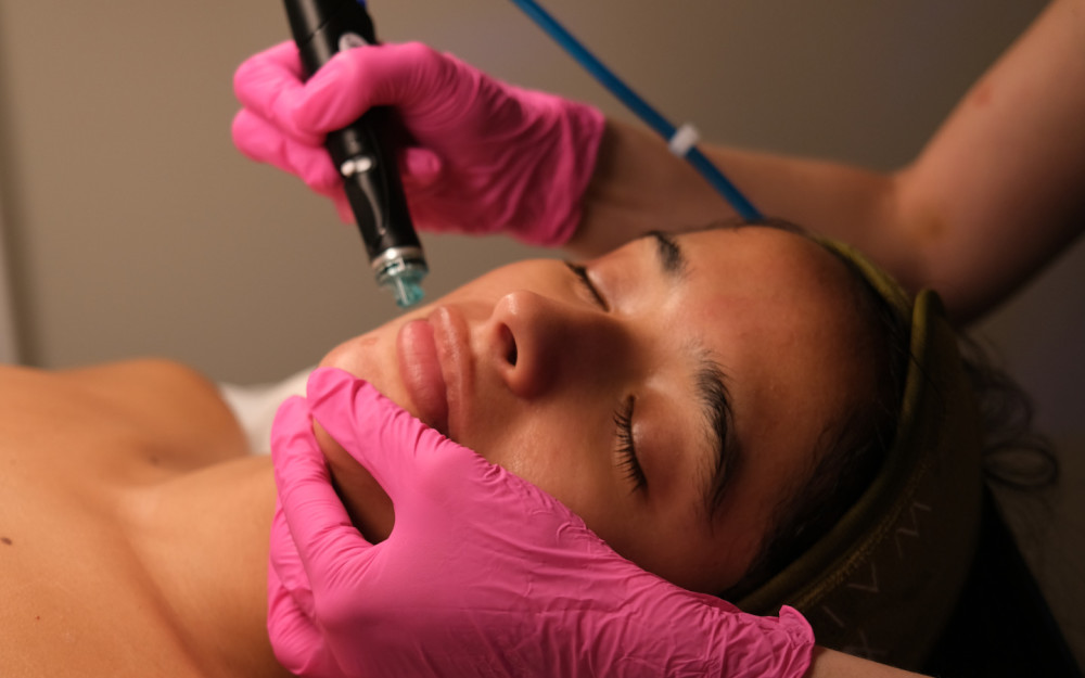 Hydrafacial Signature