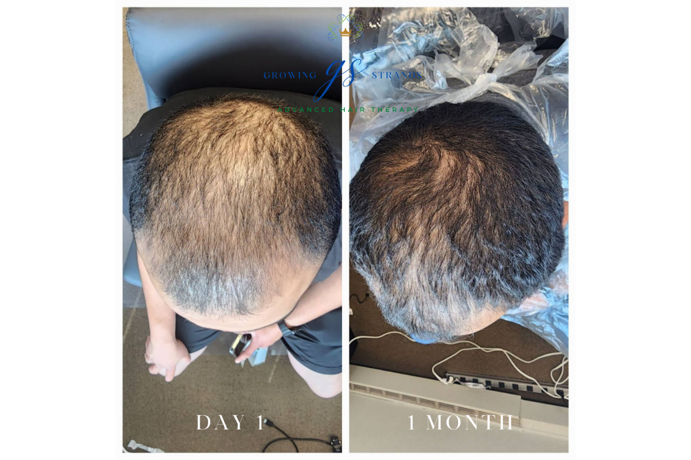 before/after