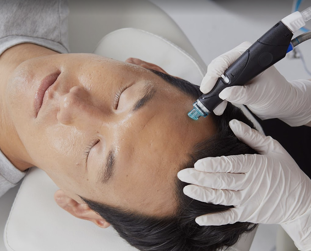 SkinGuru HydraFacial