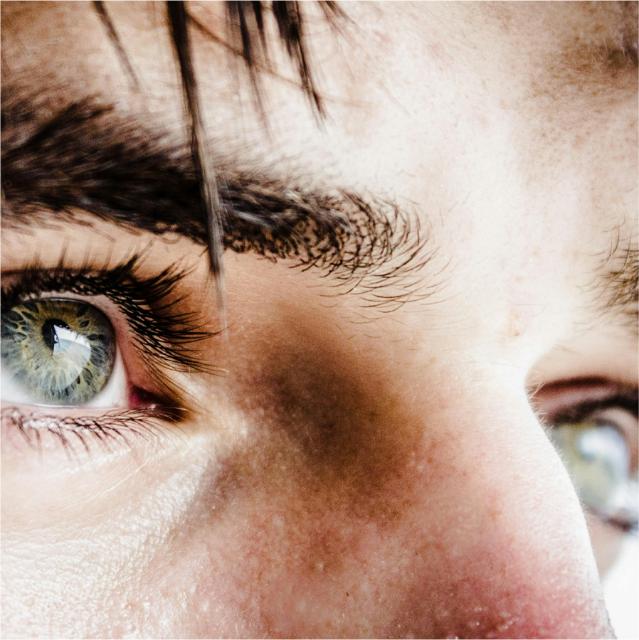 Close up image of a white face showing only the green eyes and bridge of the nose