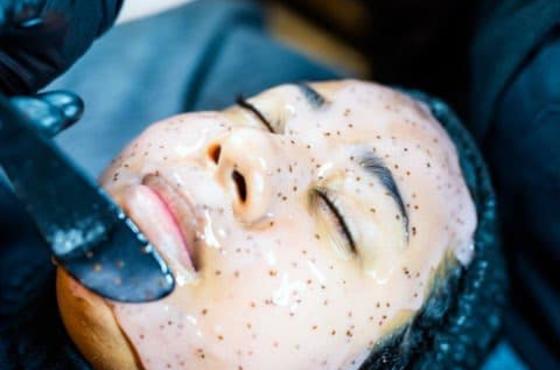 Dermaplane Facial